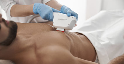 Depilación láser y foto depilación